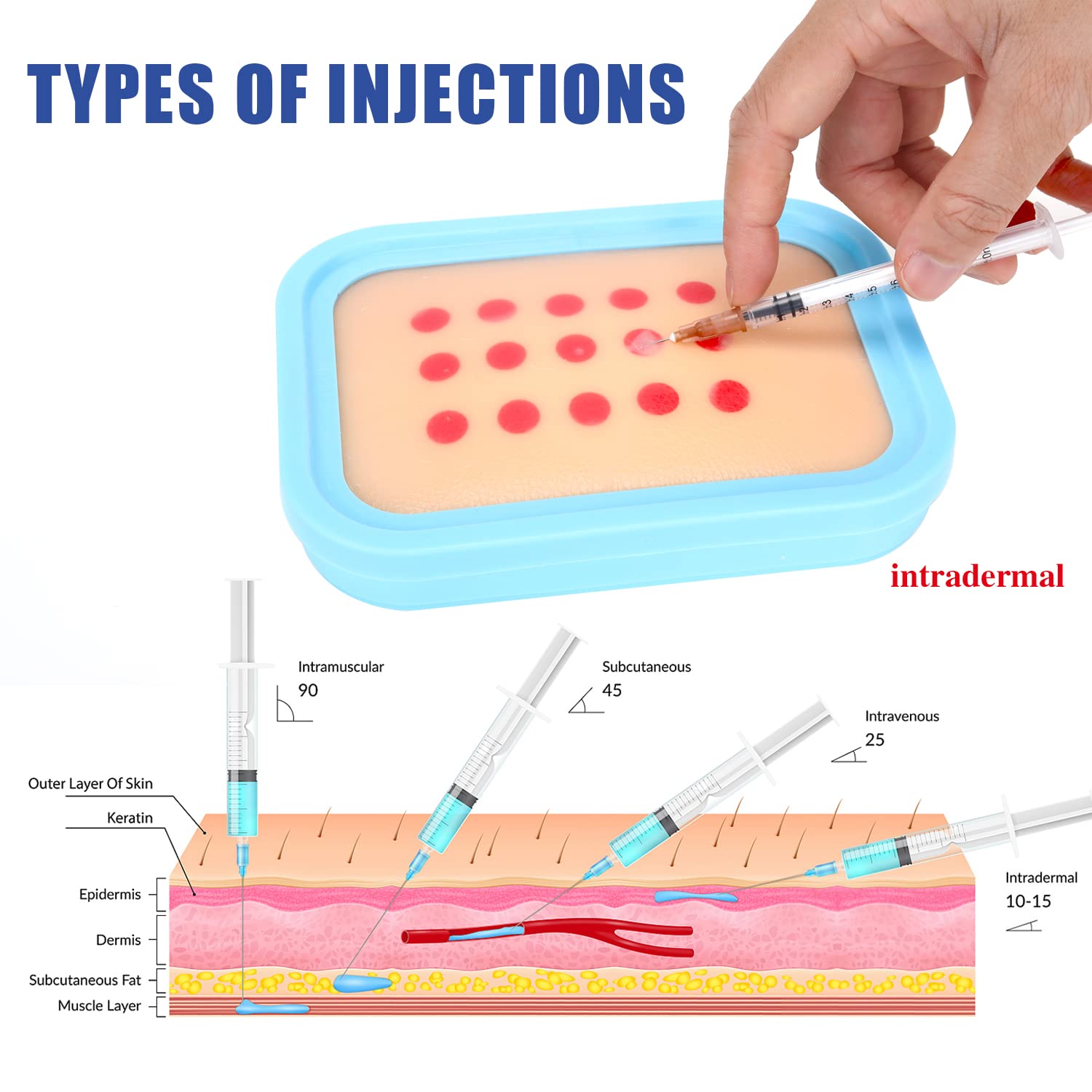 intradermal injection sites