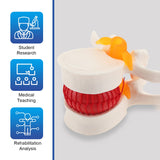 Lumbar Disc Herniated Model Human Anatomical Lumbar Spine Model