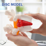  Human Lumbar Disc Herniated Model Human Anatomical Lumbar Spine Model