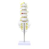 LYOU Life Size Lumbar Spine Model Lumbosacral Segment Model with A Herniated Disc At L4 and Spinal Nerves