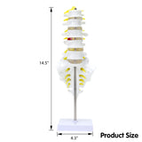 LYOU Life Size Lumbar Spine Model Lumbosacral Segment Model with A Herniated Disc Size