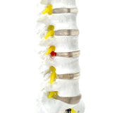 LYOU Life Size Lumbar Spine Model Lumbosacral Segment Model with A Herniated Disc At L4 and Spinal Nerves