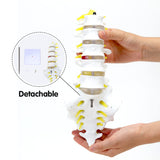 LYOU Life Size Lumbar Spine Model Lumbosacral Segment Model with A Herniated Disc Detachable