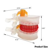 LYOU Human Lumbar Disc Herniation Model Transparent Lumbar Spine Model with Elastic Software SIZE