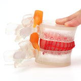 LYOU Human Lumbar Disc Herniation Model Transparent Lumbar Spine Model 