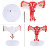 LYOU Life Size Human Uterus and Ovary Model 