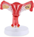 LYOU Life Size Human Uterus and Ovary Model Female Reproductive Organ Model