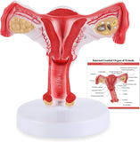 LYOU Life Size Human Uterus and Ovary Model Female Reproductive Organ Model