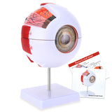 LYOU 6X Enlarged Human Eye Anatomical Model Detachable Eyeball Model 7 Parts